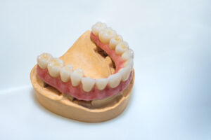 conroe implant dentures