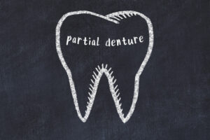 conroe partial implant dentures